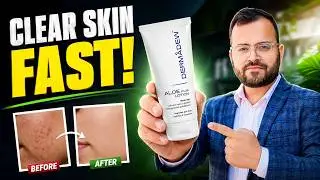 Dermadew Aloe Plus Lotion Honest Review | Uses, Benefits, Side Effects & My Experience