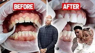 SURPRISING OUR ASSISTANT WITH BRAND NEW TEETH!!! **VERY EMOTIONAL**