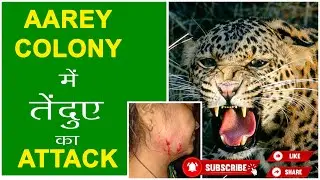 Leopard attack in Aarey Colony | Mumbai में तेंदुए के हमलों से परेशान लोग |