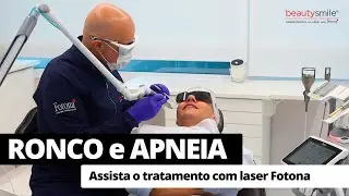 RONCO E APNEIA - PROCEDIMENTO COMPLETO - Beauty Smile