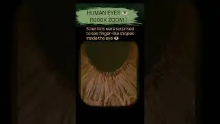 1000x Zoom Reveals a Hidden World Inside the Human Eye 👁️