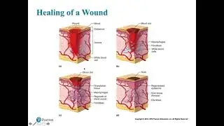 PATHOLOGY OF THE SKIN