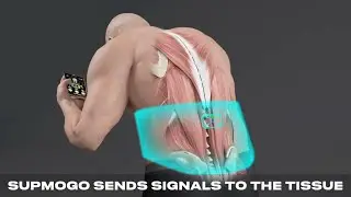Back Rehab & Strengthening Animation | How the SUPMOGO Regenerative Wearable Belt Works!