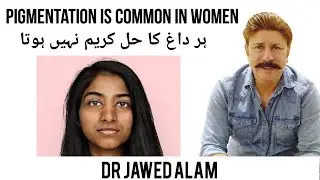 Hormonal pigmentation treatment - natural remedies for pigmentation -PCOS pigmentation