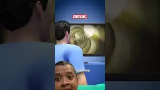 Внутри колоноскопии &mdash; источник @zackdfilms