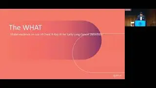 05e   Re-imaging Chest X-Ray for Finding Early Stage Lung Cancers Globally