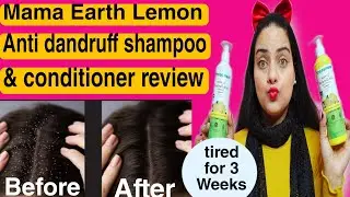 I tried Mama Earth Lemon Anti Dandruff Shampoo For three weeks l Does it really work ? 🤔