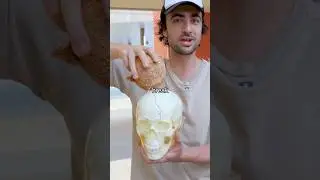 What if coconut falls on your head? #shorts #skull #interesting #usa #uk #europe #coconut