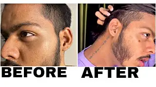 5 Grooming 😎Tips For |Boy&rsquo;s/Men&rsquo;s| hindi  Easy instantly #Grooming #ghesivlog