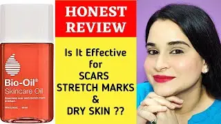 Bio Oil Review in Hindi | Bio Oil for Stretch Marks & Scars | Benefits of Bio Oil | Bio Oil for Face