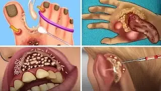 ASMR Doctor Animation 😴 | Satisfying Medical Checkup Sounds
