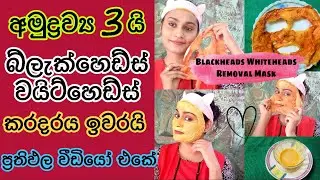 බ්ලැක්හෙඩ්ස් වයිට්හෙඩ්ස් ඉවත් කරන ක්‍රමය Easy DIY BLACKHEAD Remover Peel Off Mask INSTANT RESULTS