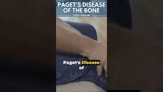 [Healthbyte] Paget&rsquo;s Disease of the bone_A medical minute!