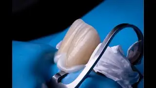 Dental Cements| Part 2| Zinc Phosphate Cement| Dental Materials. #dentalhealth #dentalmaterials 