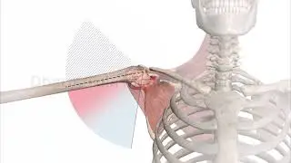 Stage of Frozen Shoulder | Stage of Adhesive Capsulitis | Capsulitis | Shoulder Joint | Pathology