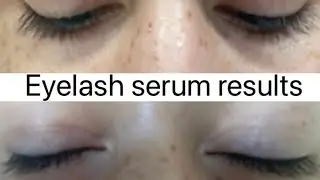 Eyelash Serum Results! 