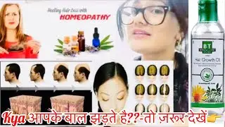 Hair Fall??Baldness??बालों का झड़ना,गंजापन ? Alopecia Treatment By Dr.Rukmani Choudhary