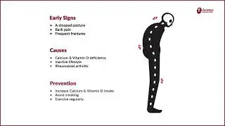 World Osteoporosis Day 2022: Importance of Calcium & Vitamin D | Zuventus Healthcare