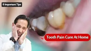 Sure Relief of Tooth Pain at Home | Tooth Pain / Toothache Relief in Emergency.