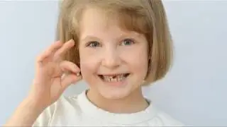 Your Dental Health: Dr Richard Caron: Space Maintainers in Children