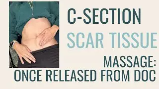 C-section Scar Tissue Massage: Once released from your doctor