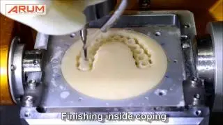[Dental CNC] PMMA Temporary Bridge