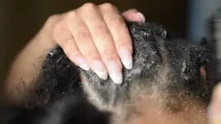 scratching my absolutely filthy hair | cornrow scratching