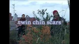 Short Ideas - Twin Chin Scars