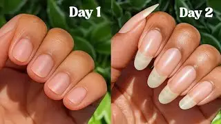 7-day nail growth boost:grows longer, thicker nail Growth naturally fast|top 10 nail growth remedies