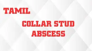 COLLAR STUD ABSCESS IN TAMIL/TYPES/PYOGENIC /TUBERCULOUS/CLINICAL FEATURES/MANAGEMENT