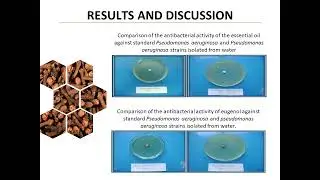 ANTIBACTERIAL ACTIVITY OF CLOVE ESSENTIAL OIL AGAINST STRAINS OF ESCHERICHIA COLI, PSEUDOMONAS...