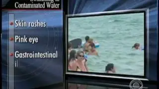 U.S. Beach Pollution Rated