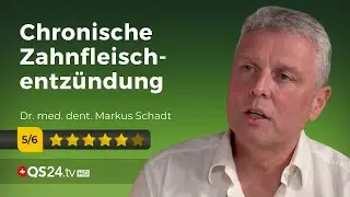 Parodontitis: Schlimmer als Karies und Co. | @QS24
