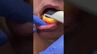 Did You Know You Could Make a 3D Scan Of Your Teeth?