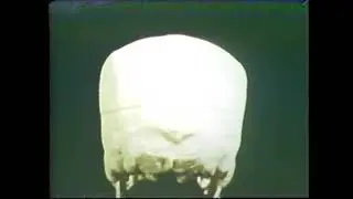 777 Vascular Structures Part III