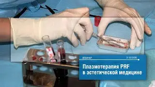 Плазмотерапия PRF в эстетической медицине.