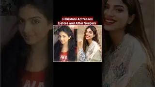 Pakistani Actresses Before and After Surgery #soniahussain #pakistanidrama  #shorts