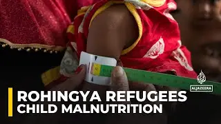 Rohingya refugee children face rising malnutrition amid aid cuts