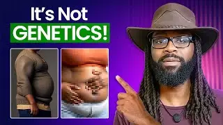Being Fat Is A Choice: The Hard Truth