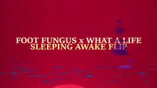 Foot Fungus x What A Life [Sleeping Awake Flip]