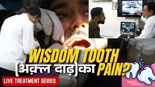 अक़्ल दाढ़ का दर्द| DR. KAPIL GUPTA