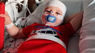 4 YEAR OLD WITH ANGELMAN SYNDROME SLEEP STUDY