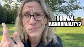 TMS Normal Abnormalities? Brain MRI #2