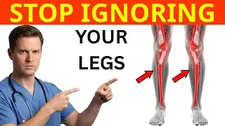 Doctor Warns: Over 60? These Silent Artery Signs Could Save Your Life