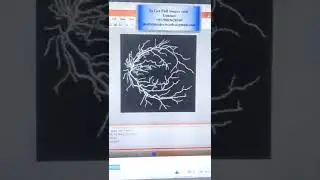 ANALYSIS OF RETINAL BLOOD VESSELS USING IMAGE PROCESSING TECHNIQUES
