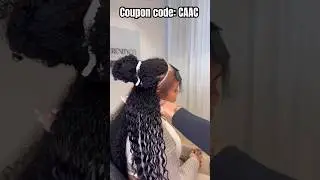 So Talented😍Closure Sew Behind Hairline | New Burmese Curly Hair Bundle | Sew In Weave Ft.#ulahair
