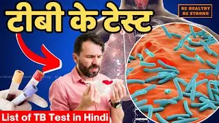 Top TB Tests | Know about the tests done for TB #tb #tuberculosis #tbtest