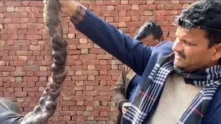 Varicose veins l Dr umar khan