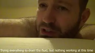 No one should live like this, fluid under skin, fluid in the body cavity