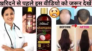 PHILLAURI ONION SHAMPOO TO STOP HAIRFALL REVIEW | PHILLAURI BLACK SEED ONION SHAMPOO FOR HAIR GROWTH